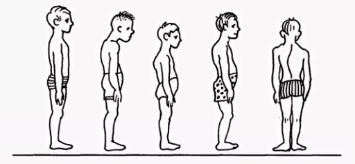 Pozas pārkāpums