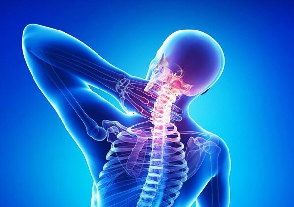 Sāpes kakla mugurkaulā ar osteohondrozi