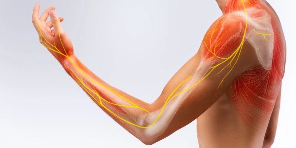 Sāpes un pirkstu nejutīgums liecina par saišu bojājumiem stenozējoša ligamentīta dēļ
