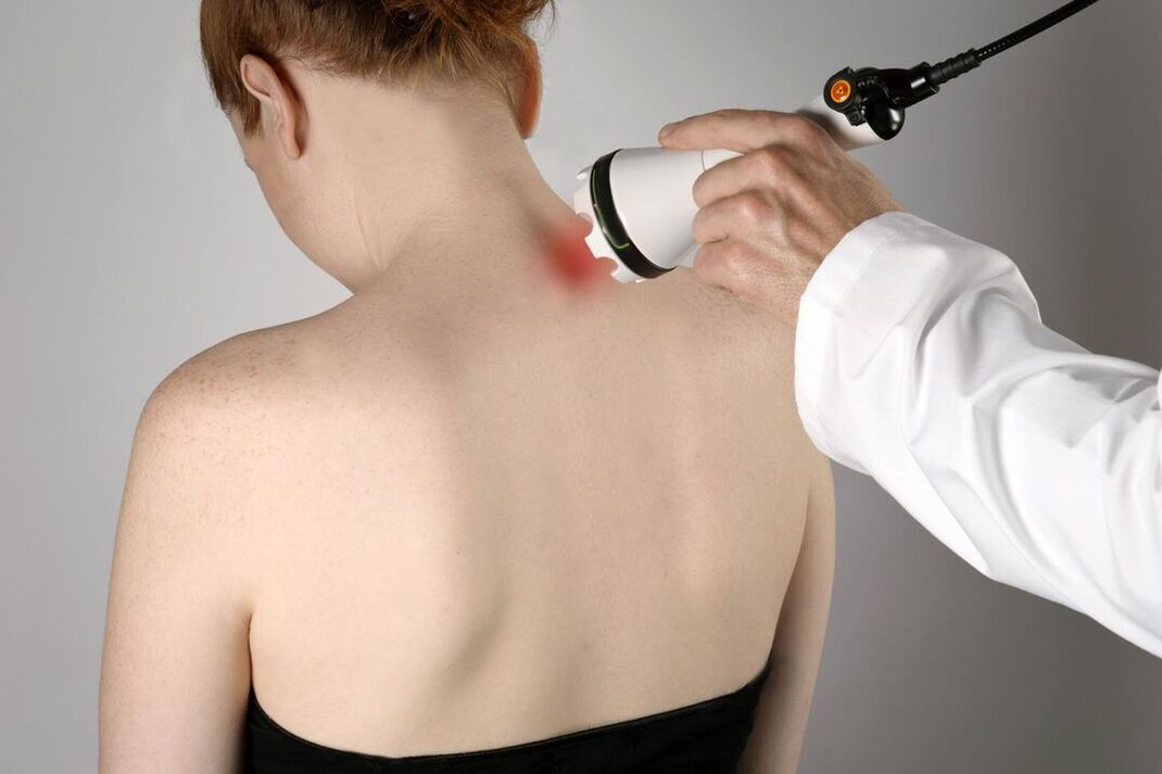 Dzemdes kakla osteohondrozes fizioterapeitiskā ārstēšana